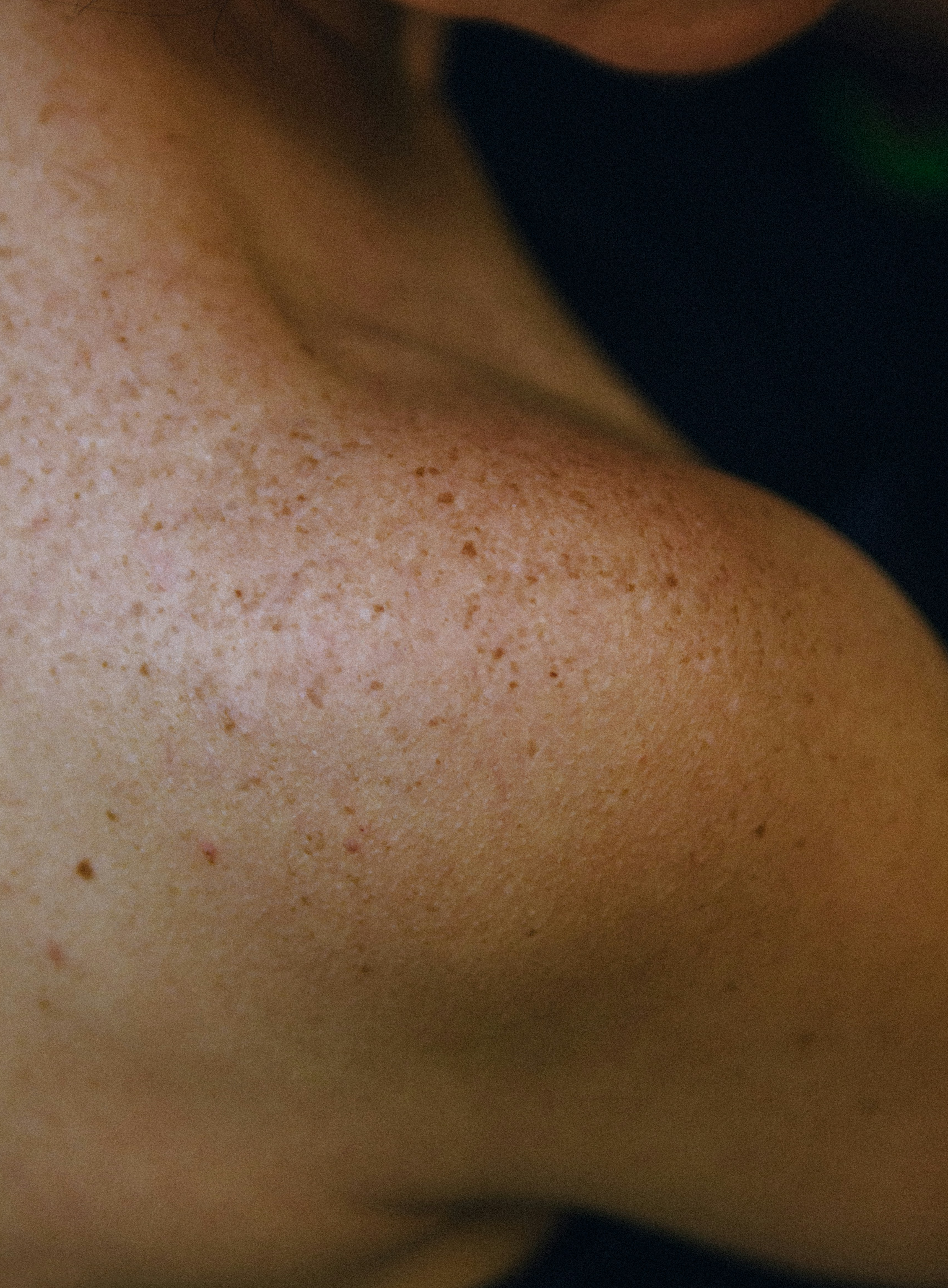 Evidence for the improvement of fatigue in fibromyalgia: A 4-week left dorsolateral prefrontal cortex repetitive transcranial magnetic stimulation randomized-controlled trial (2018)