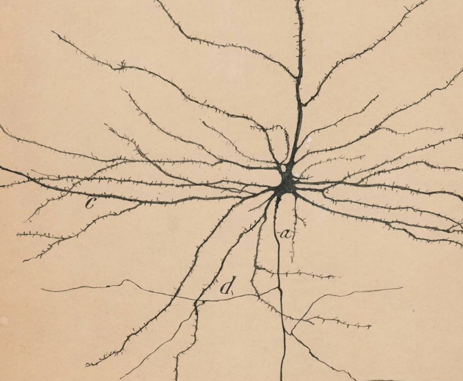 How Fibromyalgia Pain Points Affect Sleep, Mood, and Quality of Life