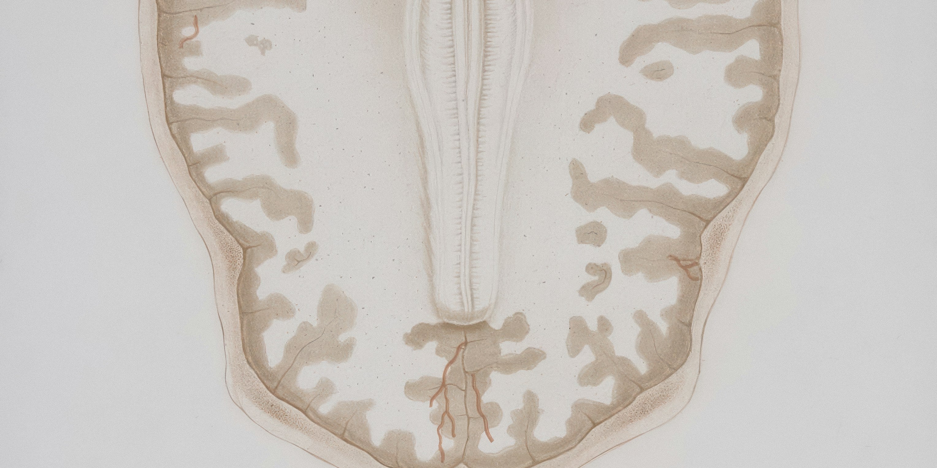 Repetitive transcranial magnetic stimulation at low frequency for the treatment of fibromyalgia (June 2025)